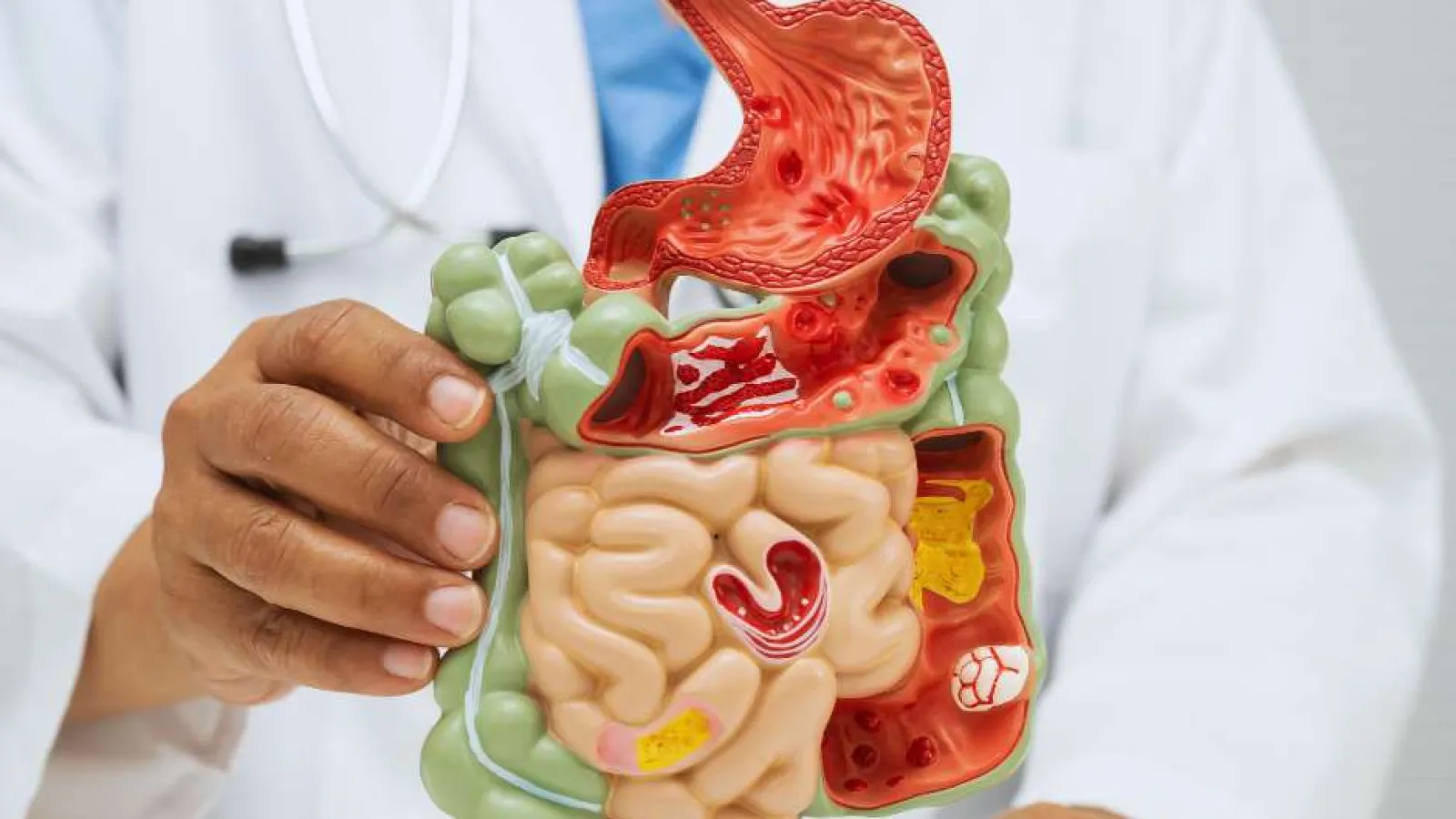 Doctor holding a detailed anatomical model of the human digestive system including stomach and intestines.