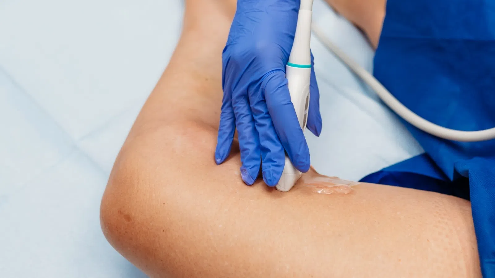 Close-up of medical professional performing ultrasound on patient's leg with gel and transducer.