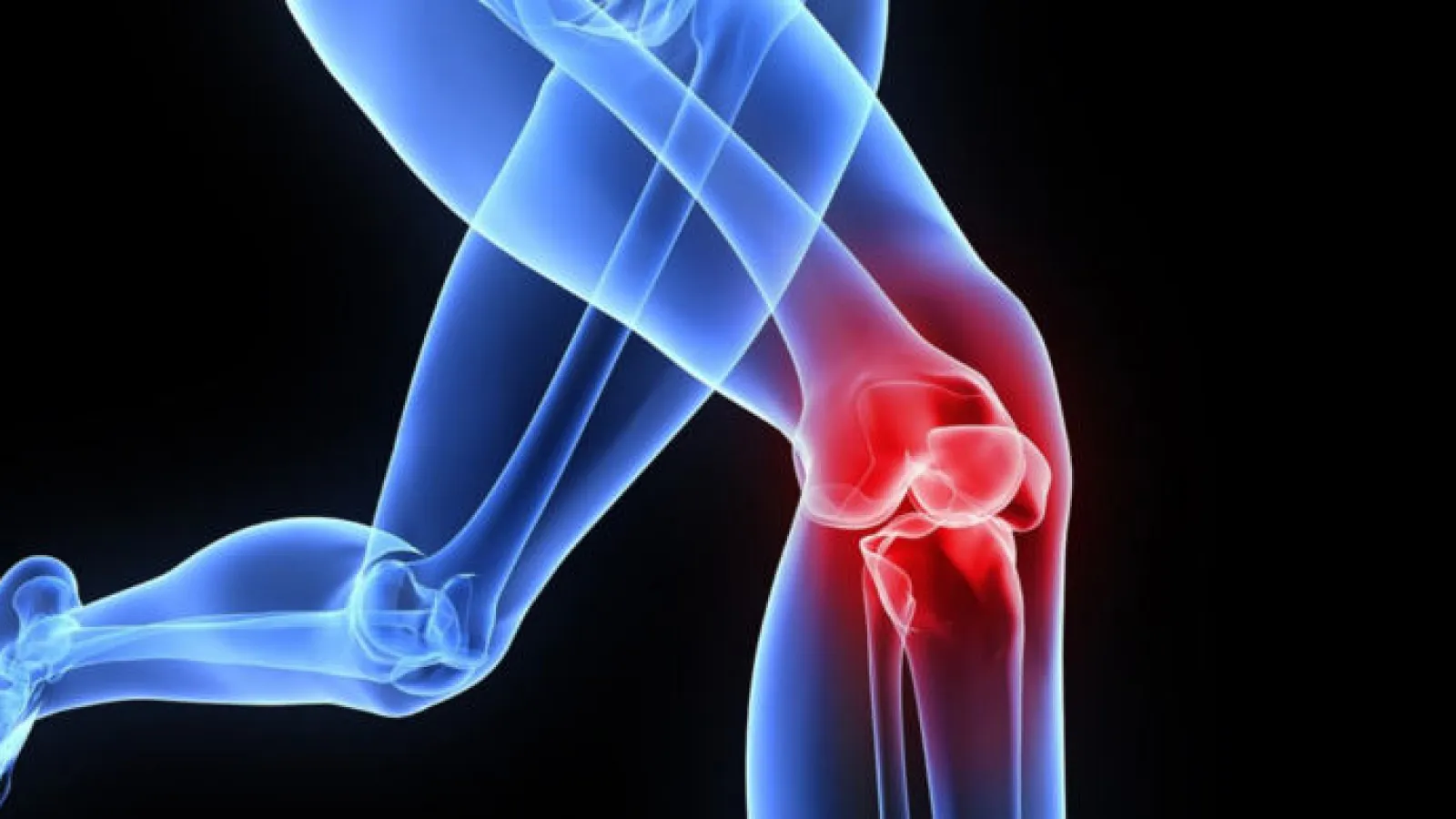 															Joint Replacement and Your Health and Well Being														