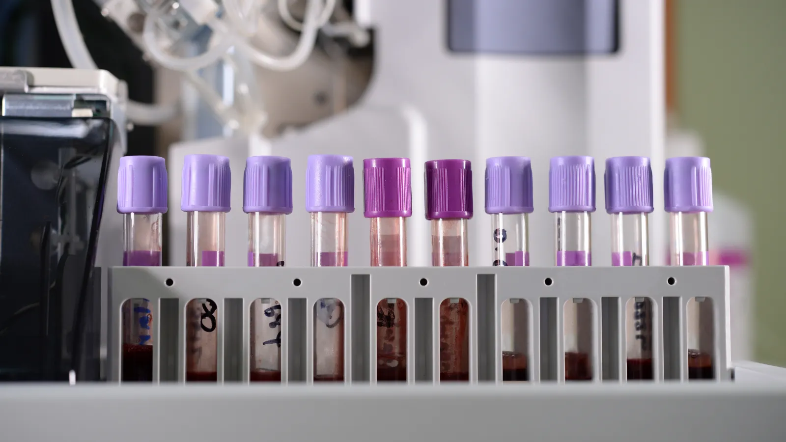 Blood test tube in a laboratory