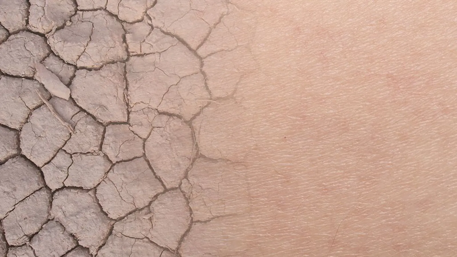 Why Your Home Has Dry Air in the Winter