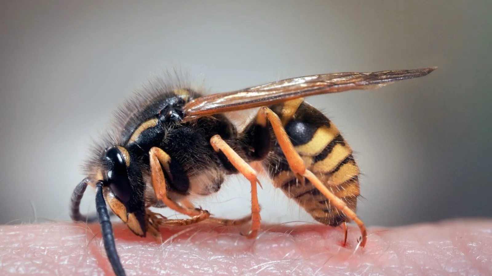 Wasp Stinging Skin