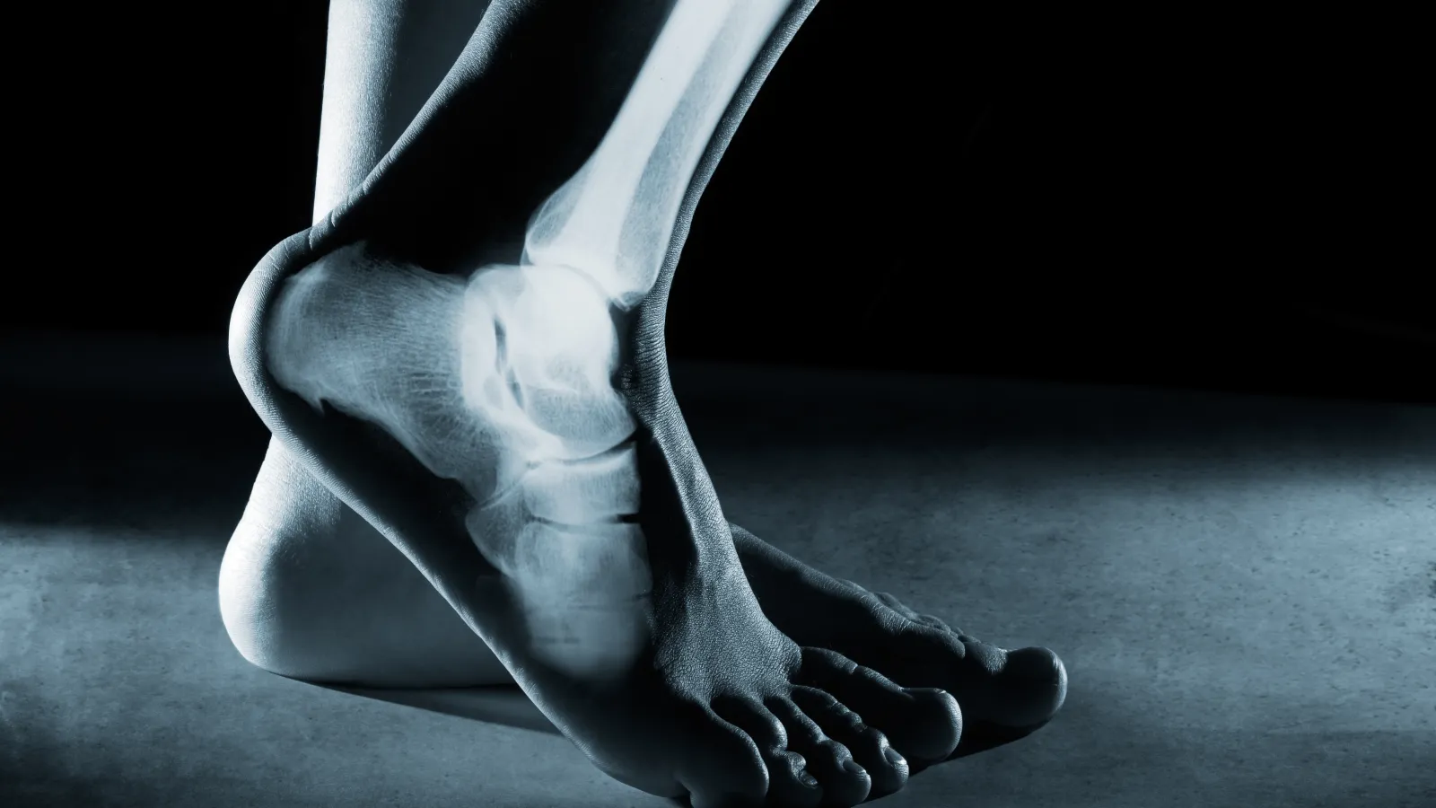 an x-ray image of a foot