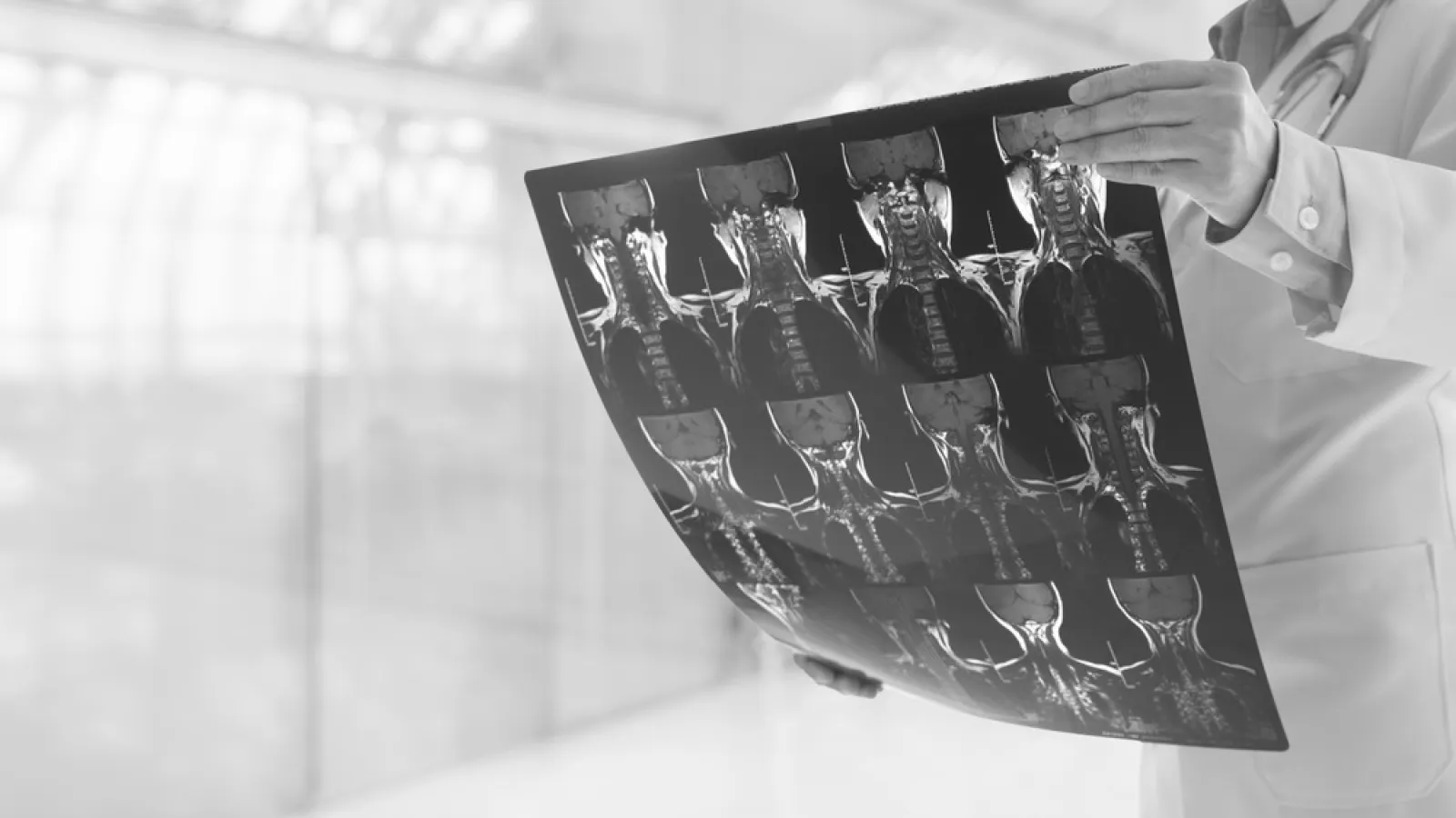 Doctor examining spinal MRI scans on a black film in a bright medical office.
