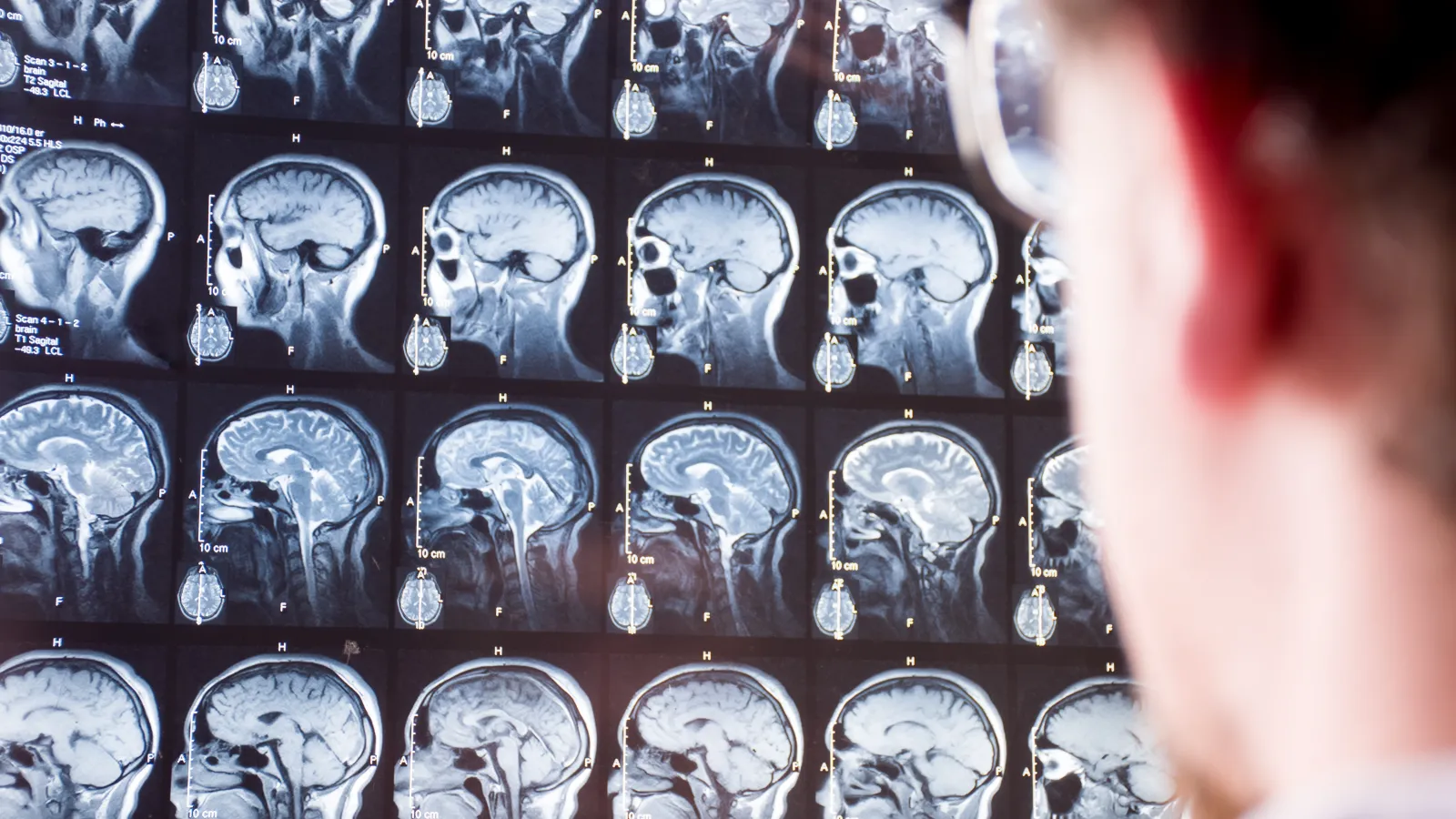 Damaged black car and white pickup truck involved in a rear-end collision on a street with traffic.