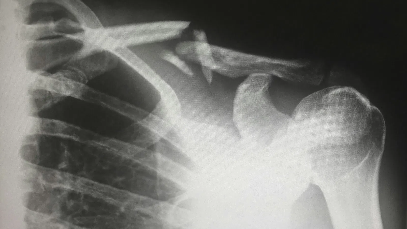 a close-up of a human hand