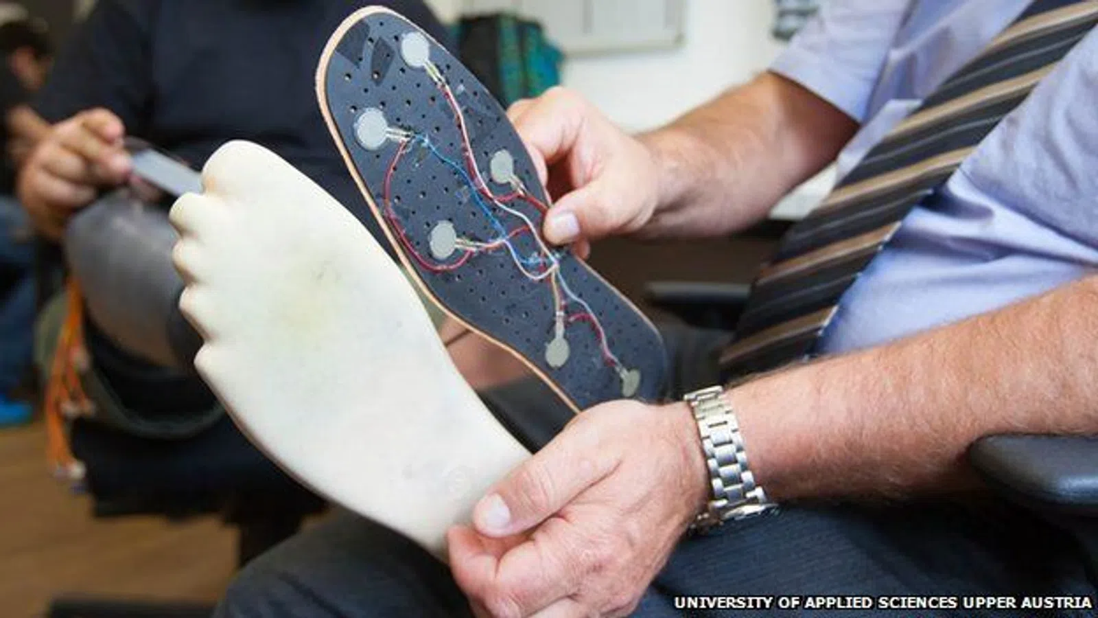 Artificial Leg Allows Patient to Feel