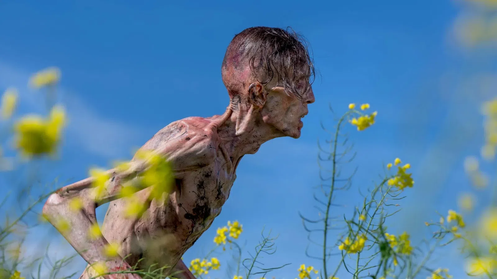 Emaciated person with visible wounds and scars leans forward among yellow wildflowers against a clear blue sky.