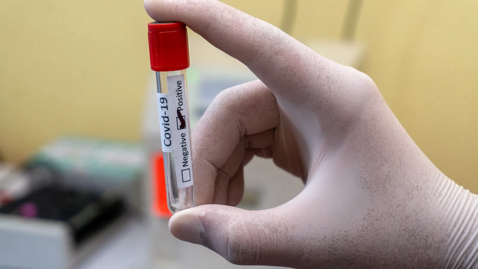The Ins and Outs of COVID-19 Testing