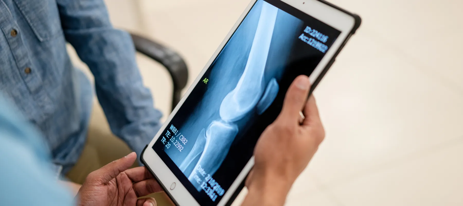 Doctor showing a knee joint X-ray on a tablet to a patient in a medical office setting