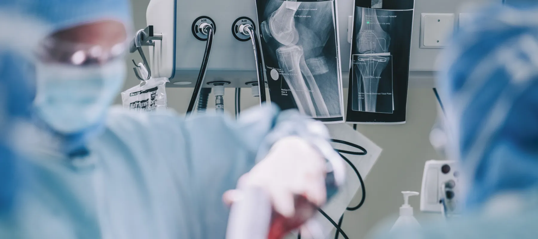 Surgeons in the operating room with X-ray images of a knee joint displayed on a medical device.