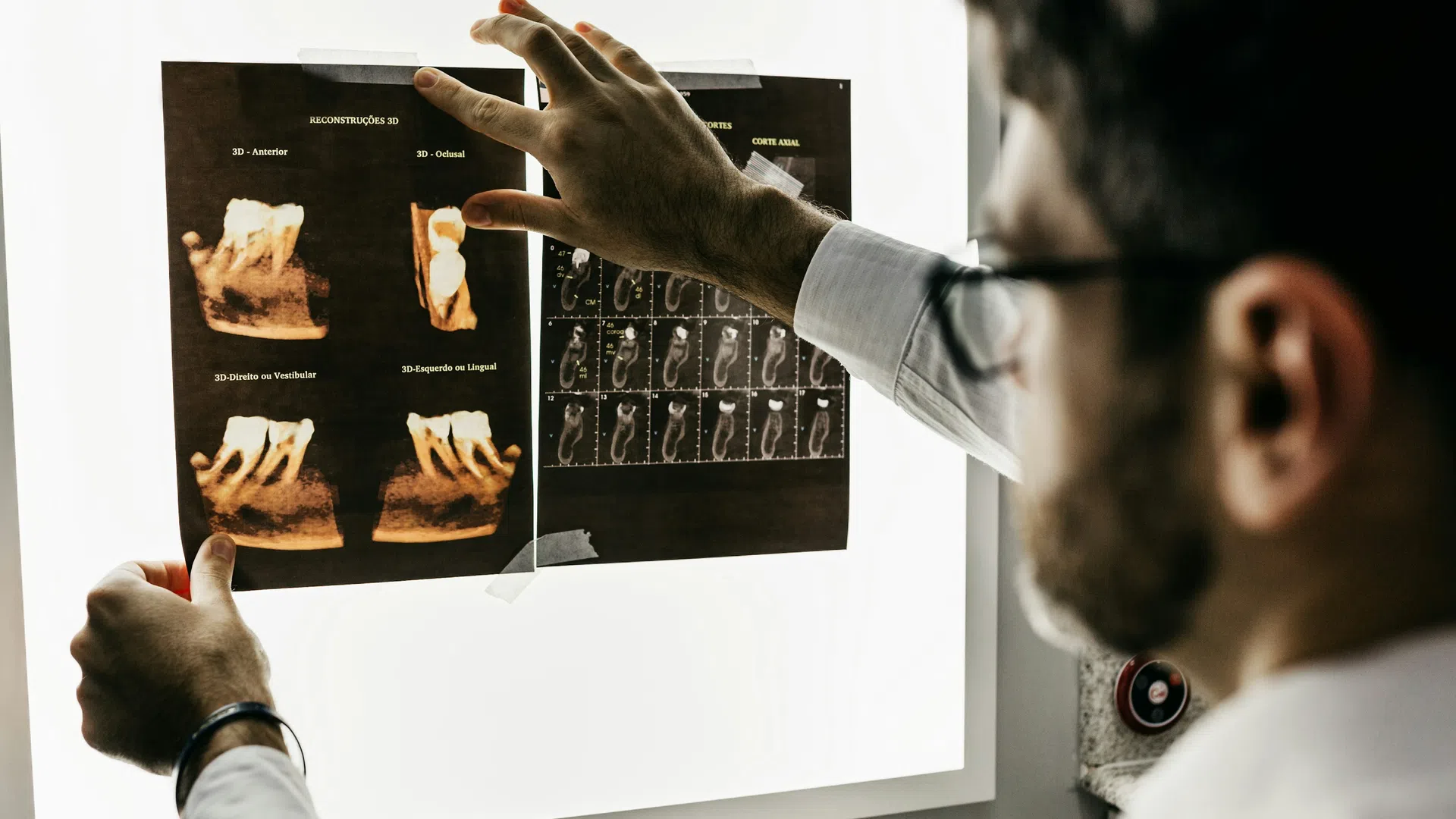 Dentist examining detailed dental X-rays and 3D scans on lightbox for tooth analysis