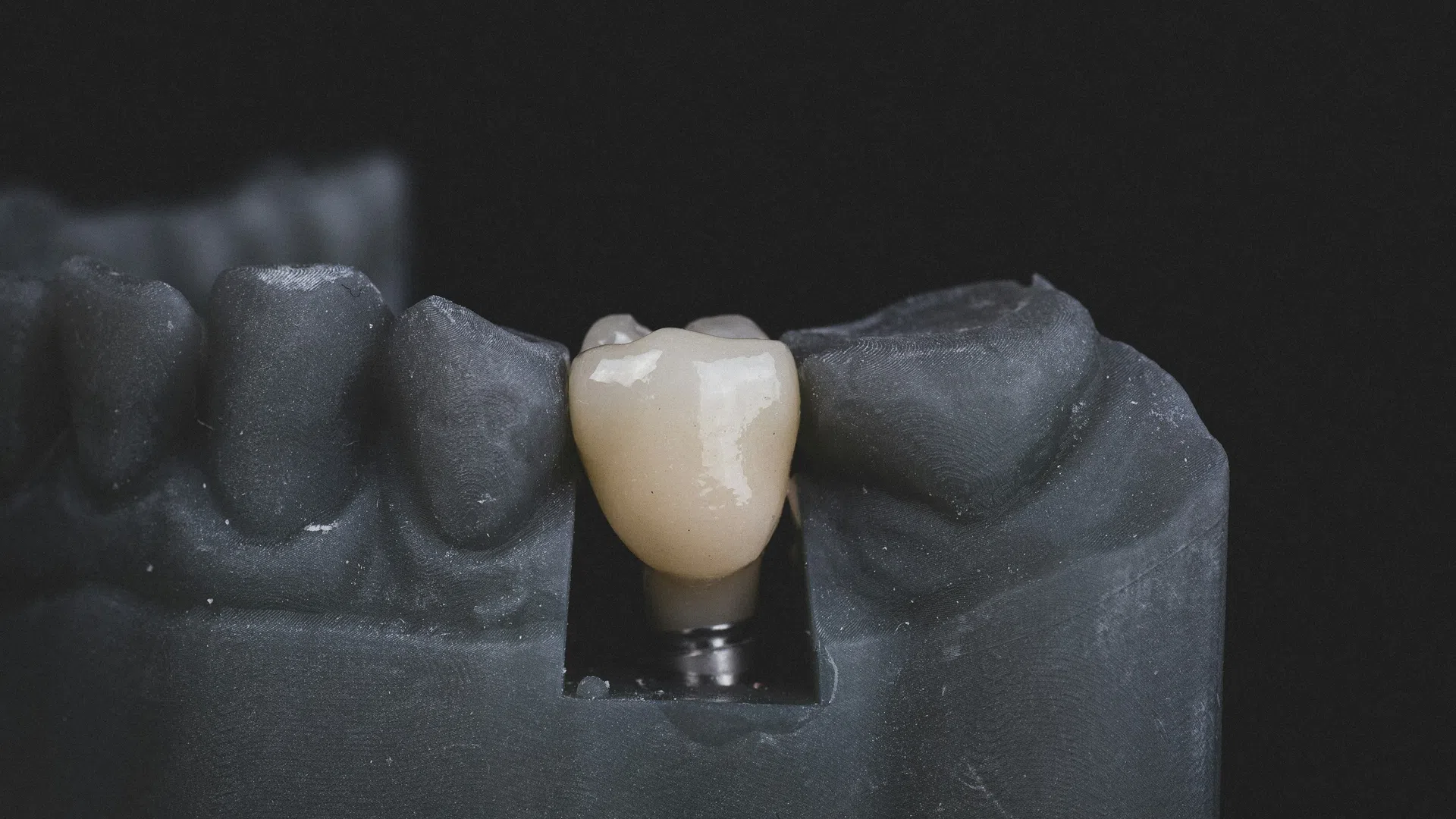 Close-up of a dental implant crown mounted on a black dental model against a black background