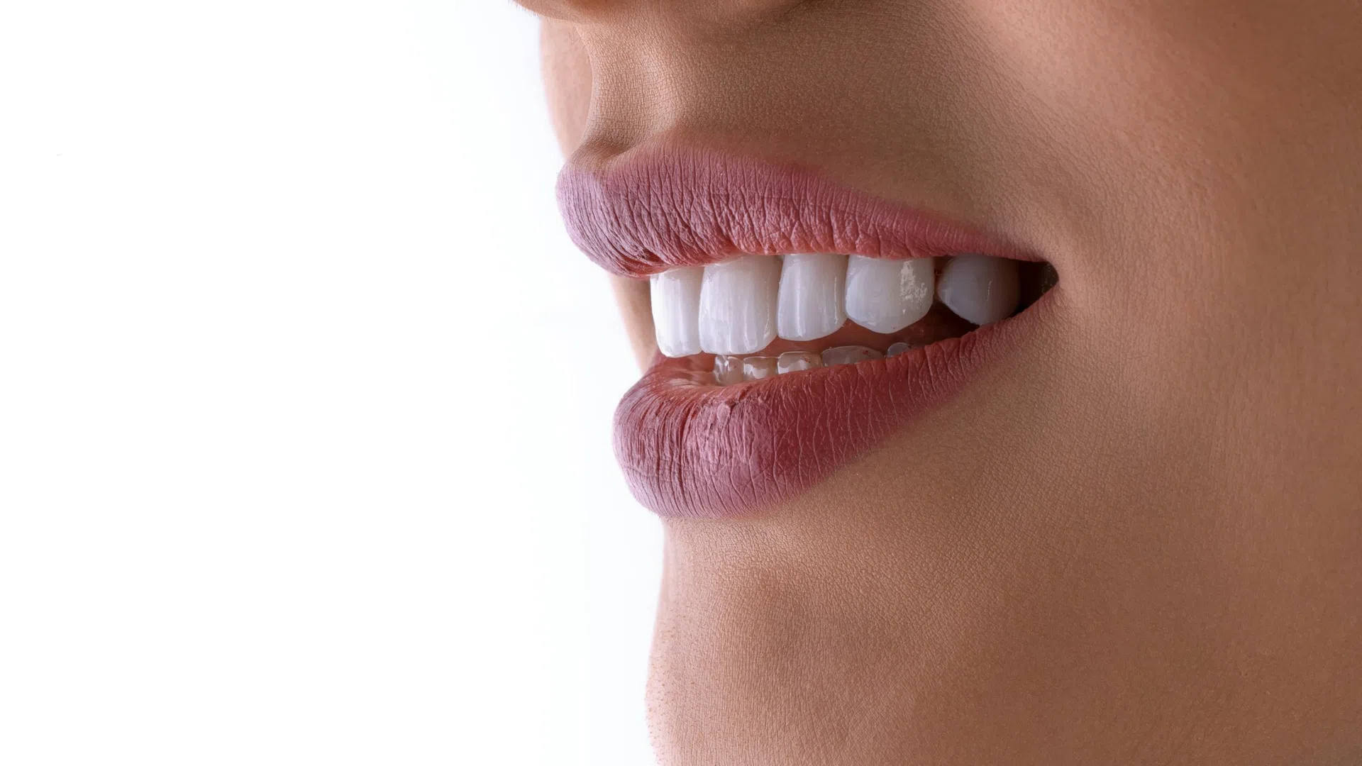 Close-up of a smiling woman’s lips and white teeth with natural skin tone on a white background