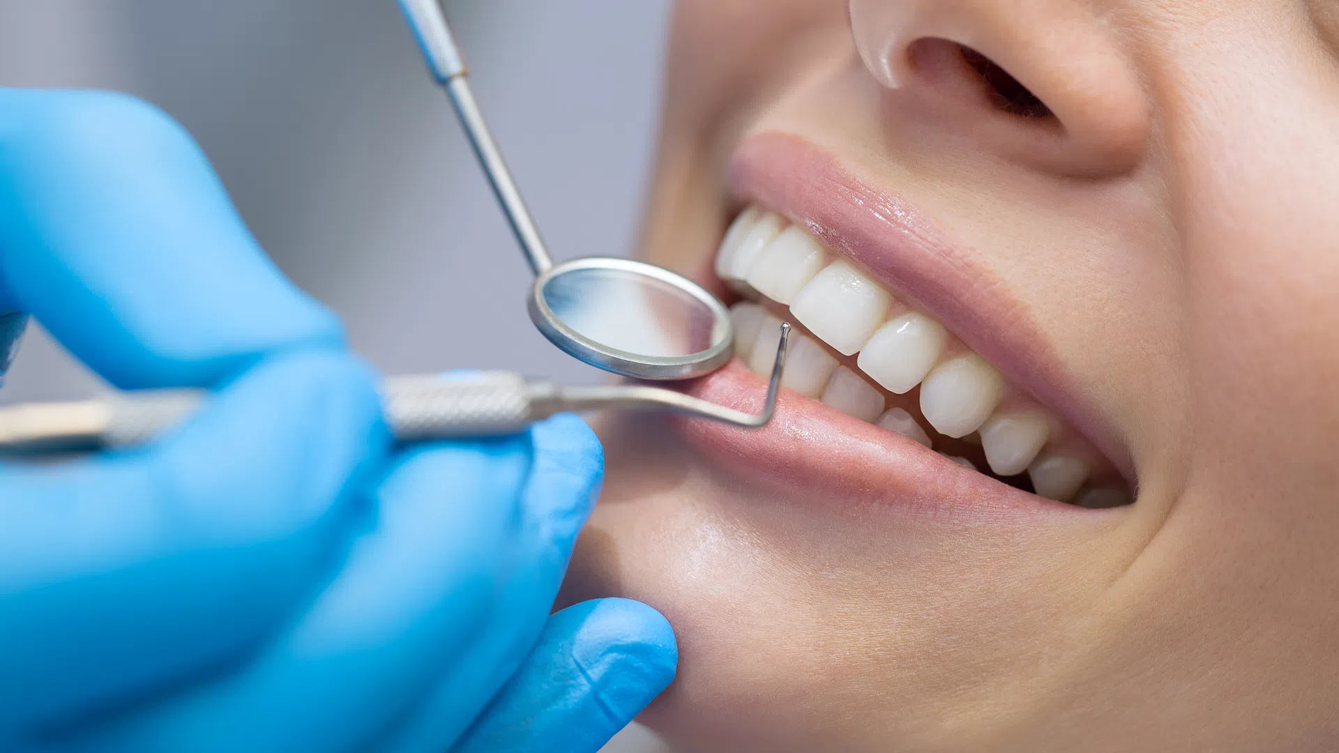 Dentist examining a patient's clean teeth using dental mirror and scaler wearing blue gloves.