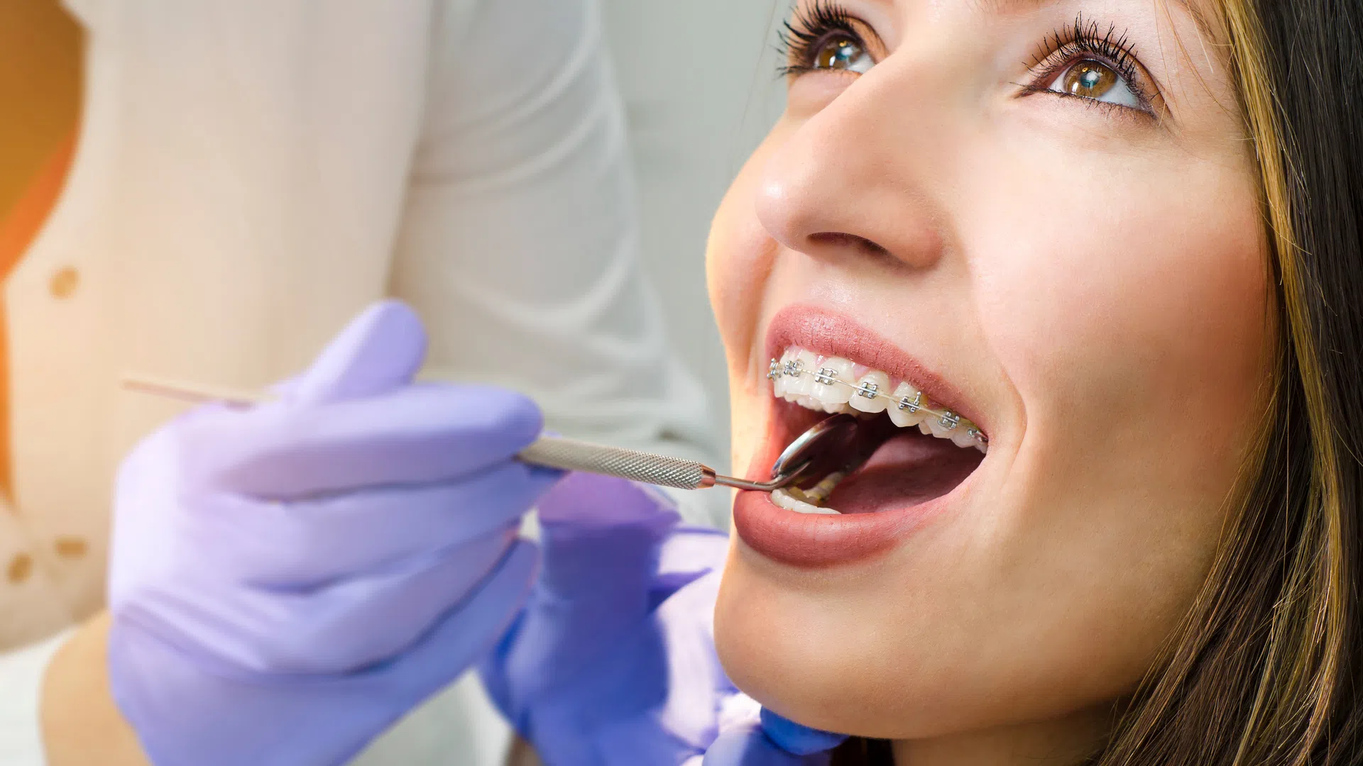 Close-up of a smiling woman with braces receiving a dental checkup from a dentist wearing purple gloves.