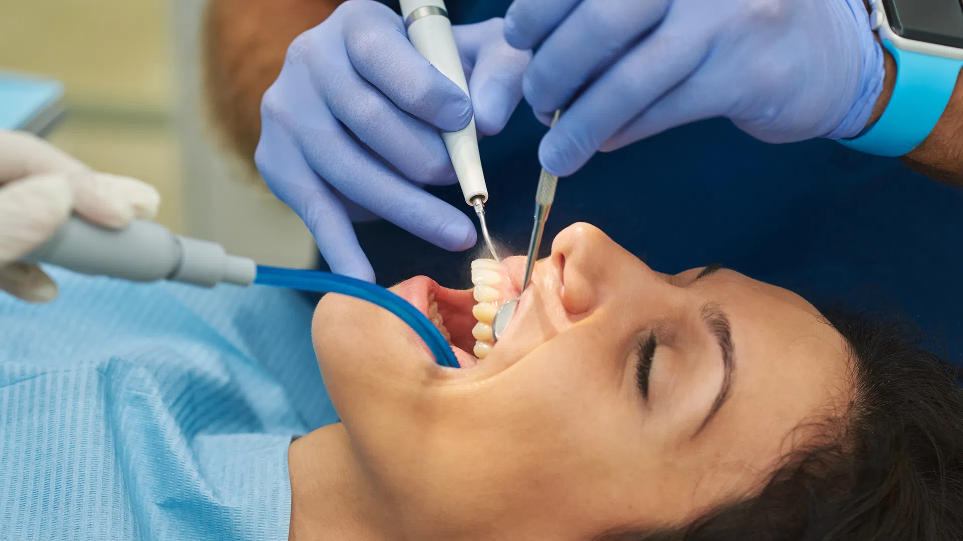 Close-up of a woman receiving dental treatment with tools and a blue suction device from a gloved dentist.