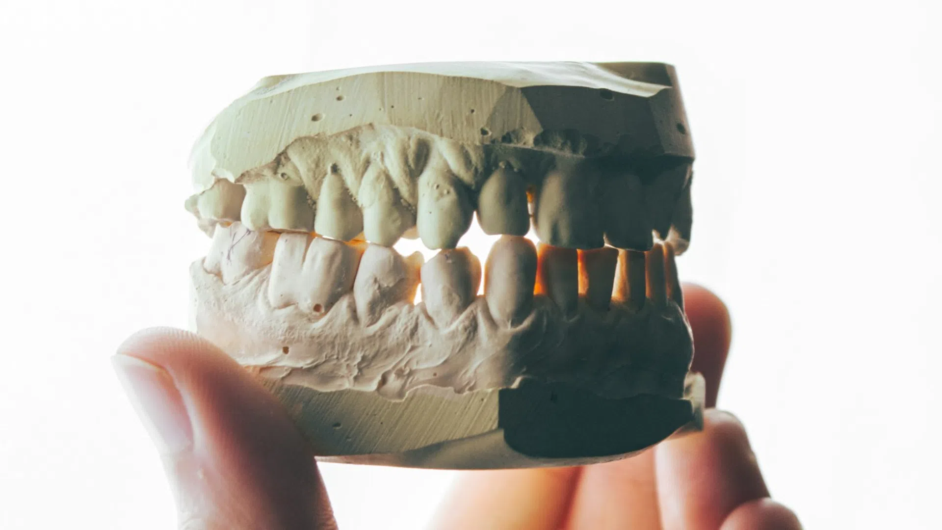 Close-up of a dental plaster mold showing detailed upper and lower teeth held by fingers with light shining through.