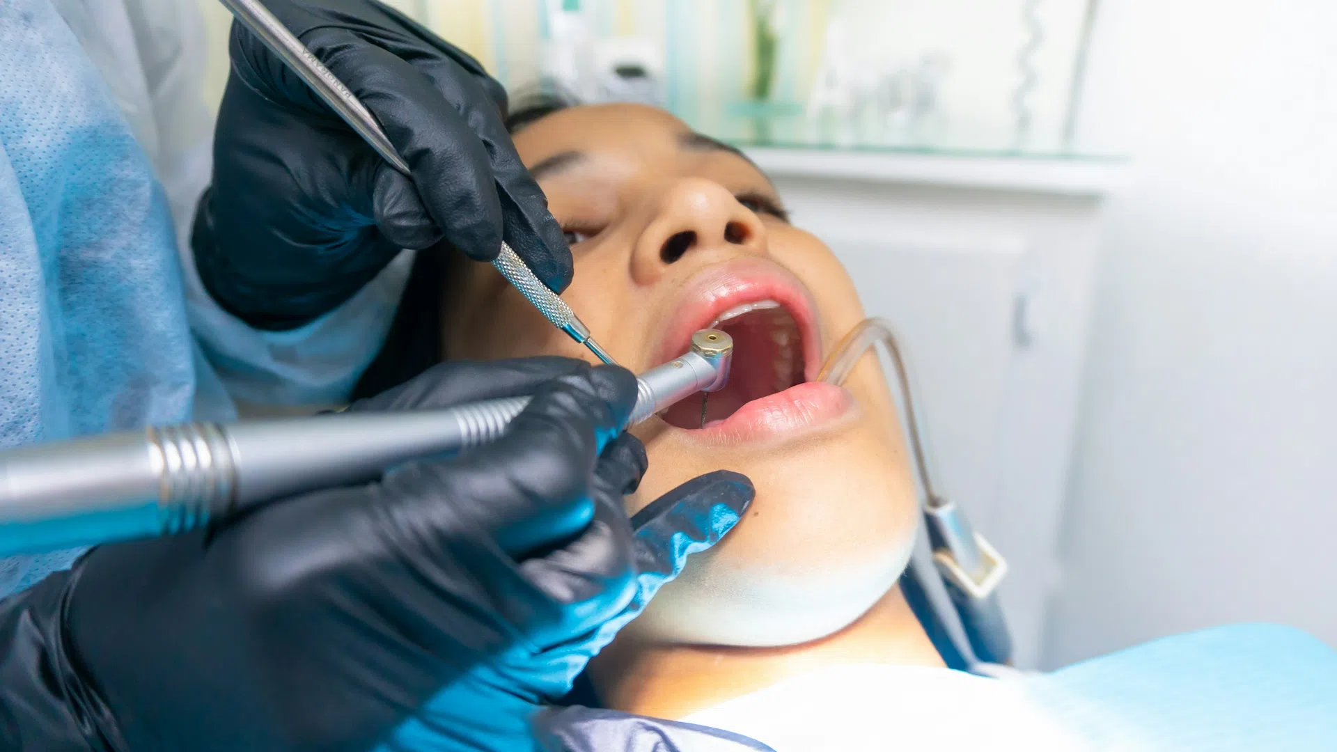 Dentist in black gloves performing dental treatment on patient using dental tools in clinic.