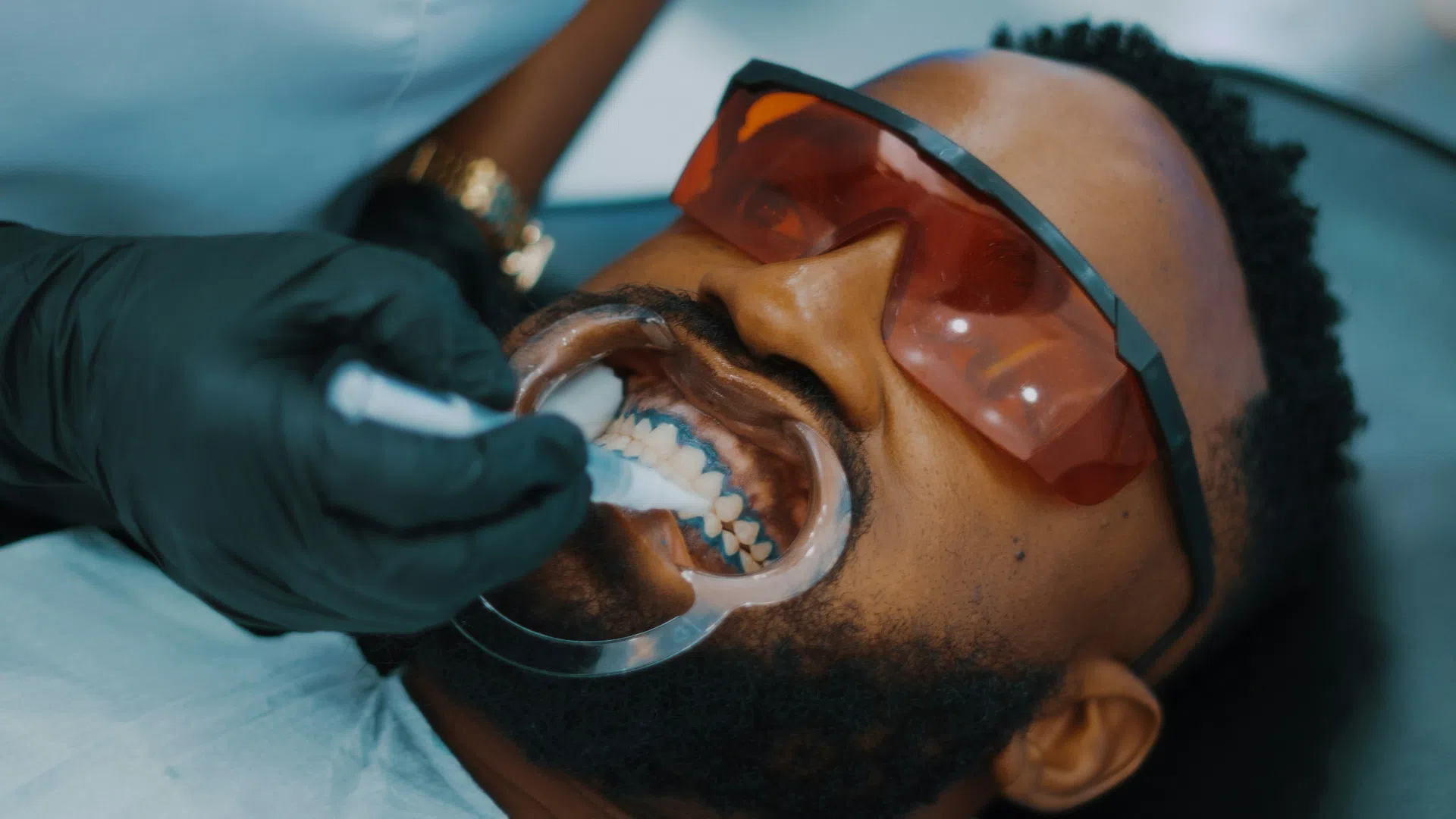 Man wearing protective glasses undergoing teeth whitening treatment at dental clinic