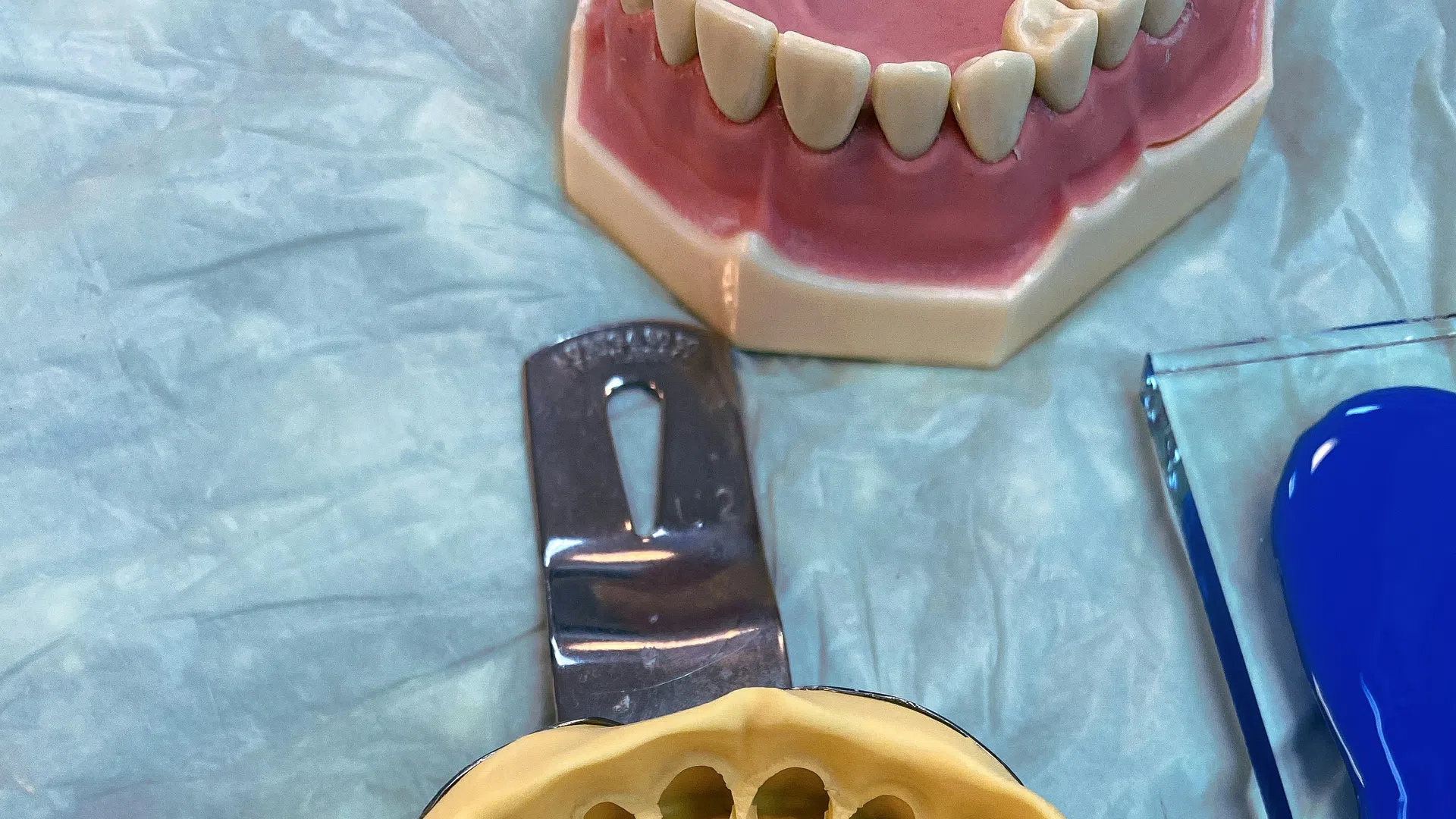 Dental mold of upper teeth with dental tools and a model of lower teeth on a blue dental sheet.