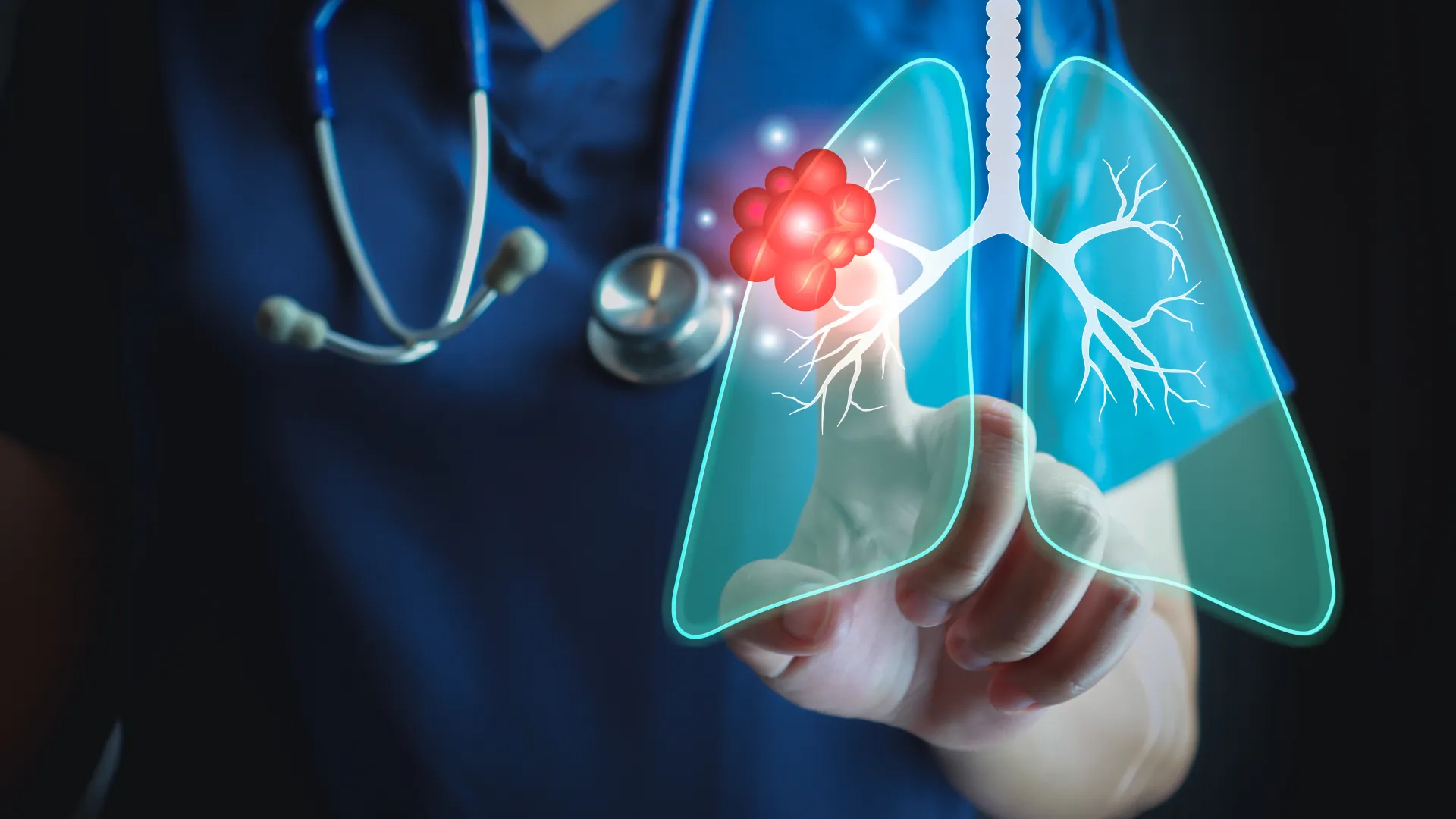 Healthcare professional illustrating lung cancer using digital graphics and medical tools.