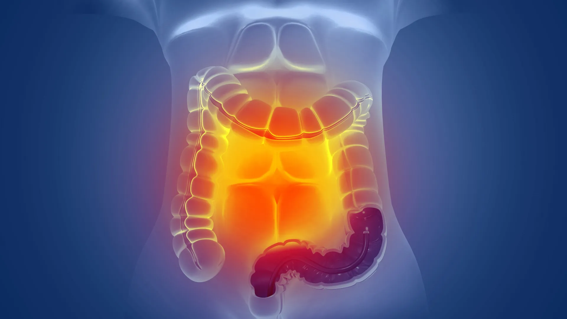 Illustration of the human digestive system highlighting the intestines in glowing colors.