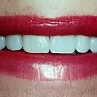 Close-up of a smiling mouth with red lipstick and white teeth on visible skin.