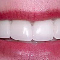 Close-up of a smiling mouth with bright white teeth and red lips showing healthy dental hygiene.