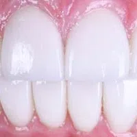 Close-up of healthy, white teeth and pink gums showing clean dental hygiene and well-aligned teeth.