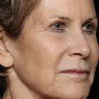 Close-up profile of an older woman’s face showing natural skin texture and expression against a black background