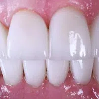 Close-up of healthy white teeth and pink gums with natural shine and smooth texture