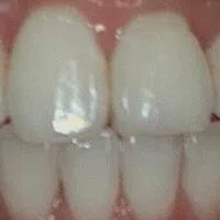 Close-up of healthy, clean human teeth with pink gums and natural shine under light reflection.