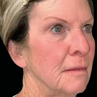 Close-up of an elderly woman with gray hair, light blue eyes, and visible wrinkles on her face and neck.