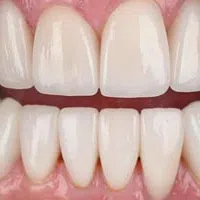 Close-up of a healthy smile showing clean, white, well-aligned teeth and pink gums