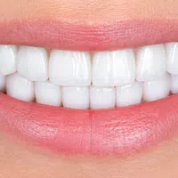 Close-up of bright white teeth with healthy pink lips smiling naturally.