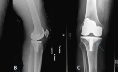 a collage of a person's legs