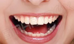 Thumbnail control image for a close-up of a person's mouth