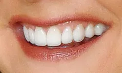 Thumbnail control image for Close-up of a smiling mouth showing clean, white teeth and natural lips with a smooth texture.