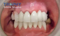 Thumbnail control image for a close-up of a person's mouth