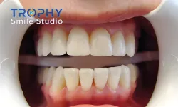 Thumbnail control image for a close-up of a mouth