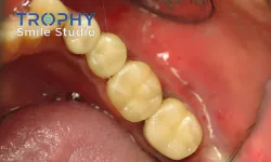 Thumbnail control image for close-up of a person's mouth