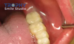 Thumbnail control image for a close-up of a person's mouth