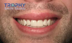 Thumbnail control image for a close-up of a person's mouth