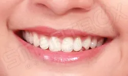 Thumbnail control image for close-up of a person's mouth