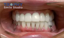 Thumbnail control image for a close-up of a person's mouth