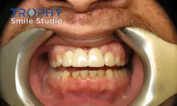 Thumbnail control image for a person's mouth with teeth