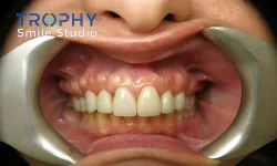 Thumbnail control image for a person's mouth with teeth