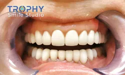 Thumbnail control image for a close-up of a mouth