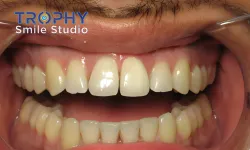 Thumbnail control image for a close-up of a person's mouth